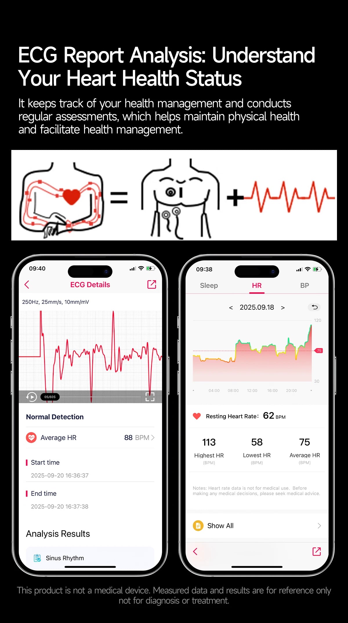 2026New AI-Diagnosis Care Smartwatch ECG+PPG Accurate Uric Acid Blood Pressure Body Fat Five organ Fitness Waterproof Smartwatch