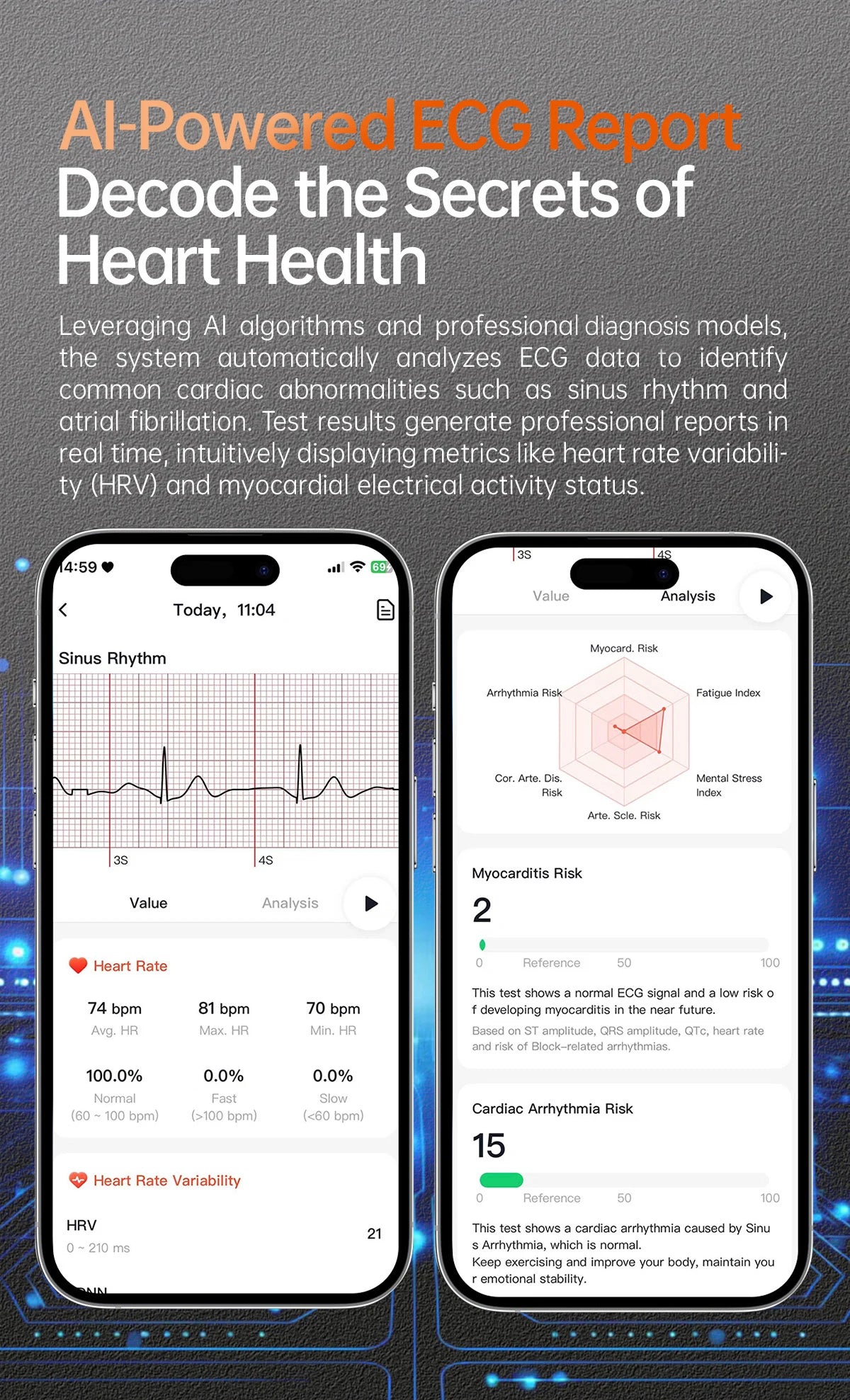 For XIAOMI 2025 New ECG+PPG Smartwatch Precise Uric Acid Blood Lipids Pressure Body Analysis Smart Watch Men BT Call NFC Watches